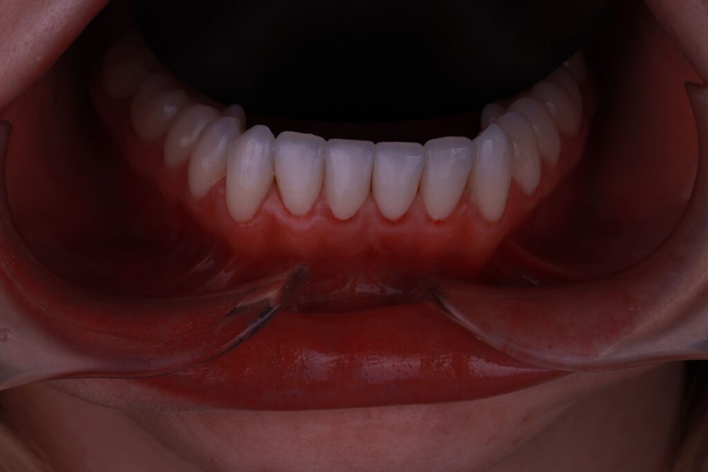 1I6A2214