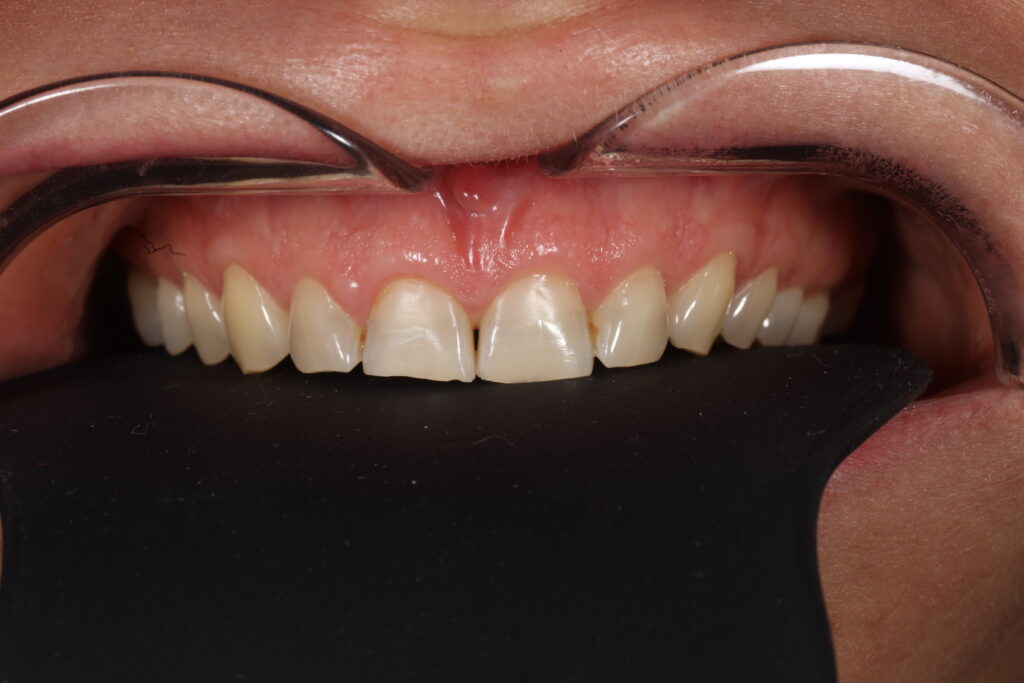 1I6A0631