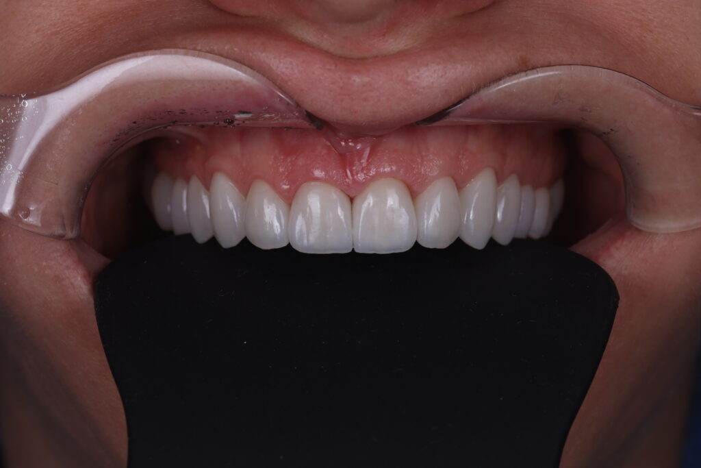 1I6A2764