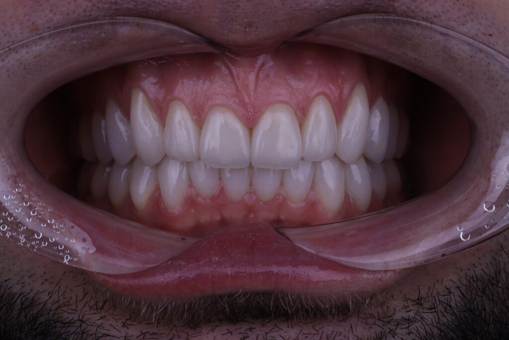 1I6A2781