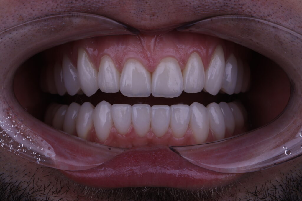 1I6A2782
