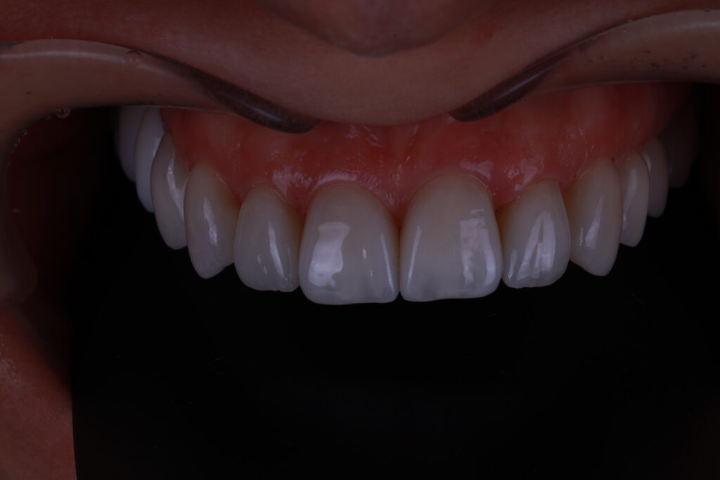 1I6A2904