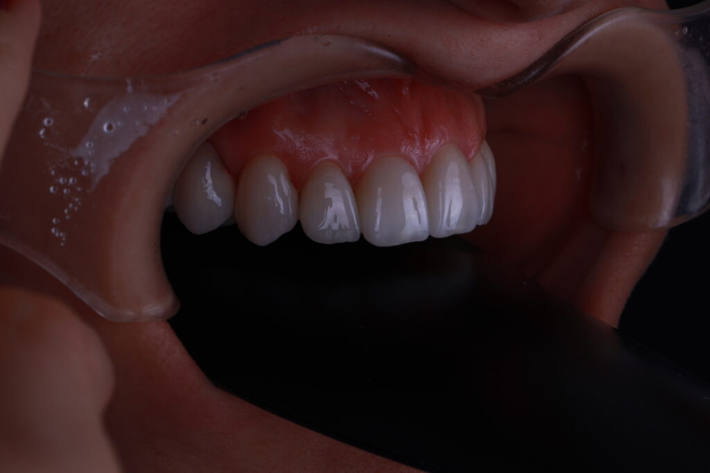 1I6A2915