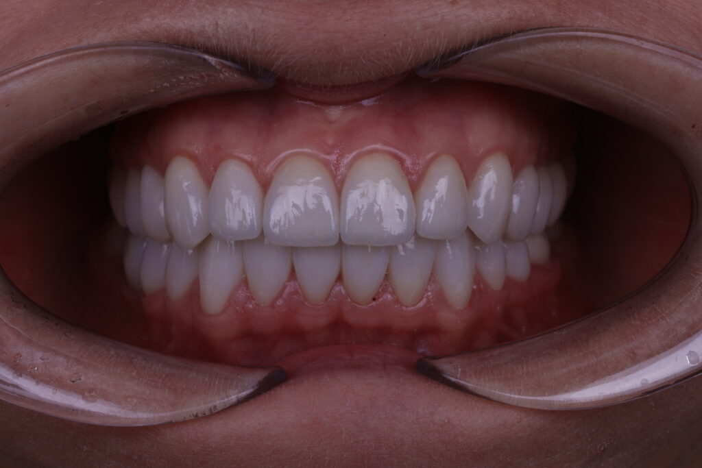 1I6A4261