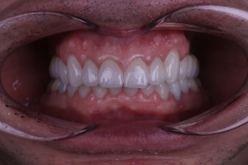 1I6A4410