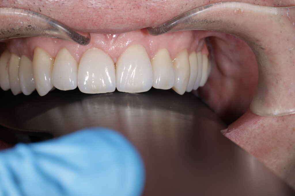 1I6A5239