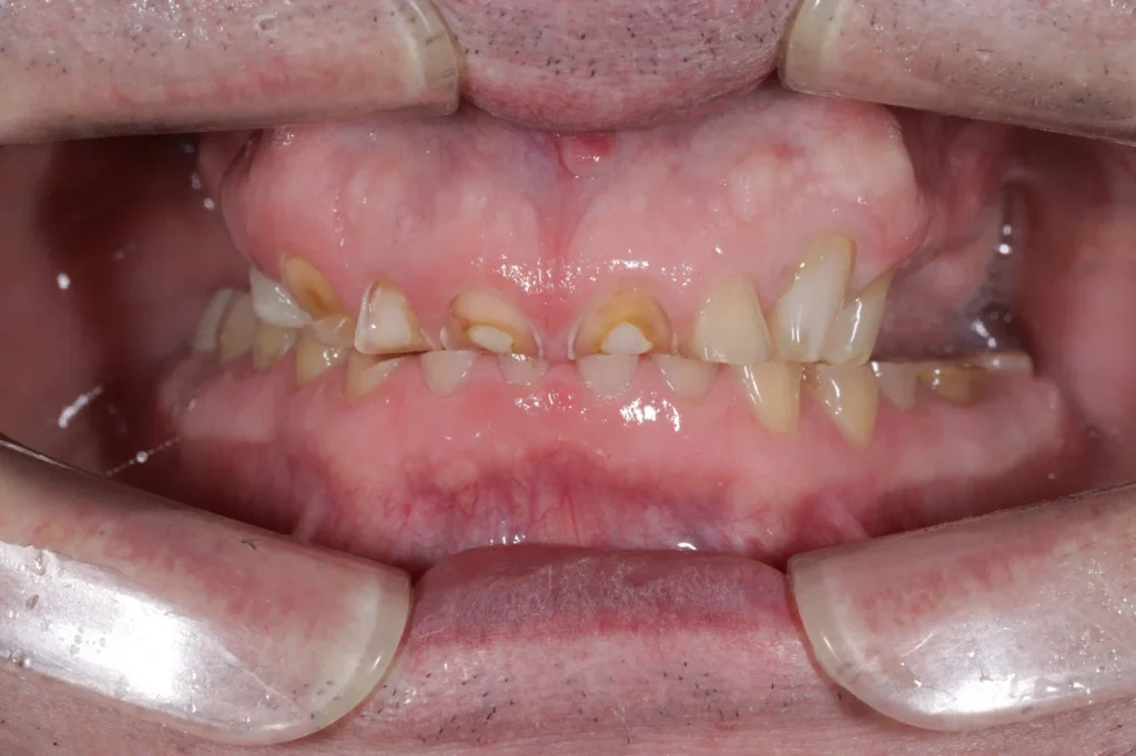 1I6A6786